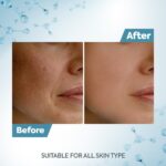 RAAGA De-Tan Tan Removal Cream with Kojic and Milk, 500 gm